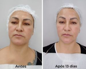 Royal Face Estética Montes Claros