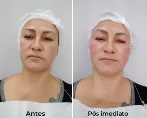 Royal Face Estética Montes Claros