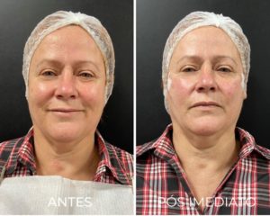 Royal Face Estética Montes Claros