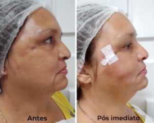 Royal Face Estética Montes Claros