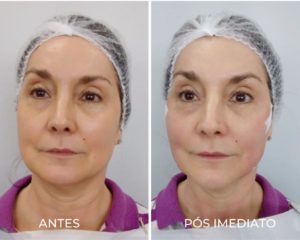 Royal Face Estética Montes Claros