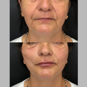 Royal Face Estética Montes Claros