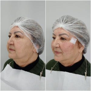 Royal Face Estética Montes Claros