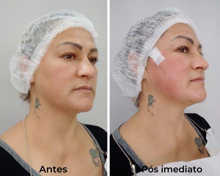 Royal Face Estética Montes Claros