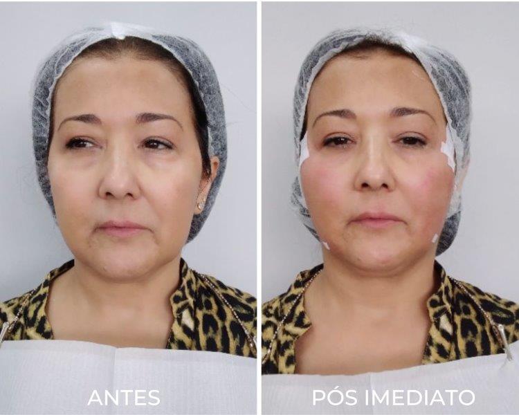 Royal Face Estética Montes Claros