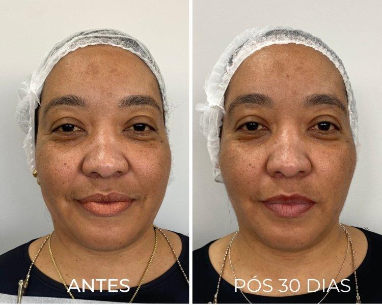 Royal Face Estética Montes Claros