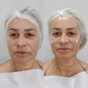 Royal Face Estética Montes Claros