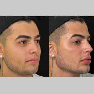 Royal Face Estética Montes Claros