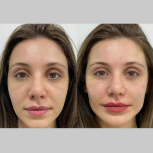 Royal Face Estética Montes Claros