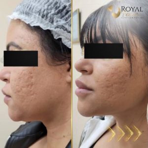 Royal Face Estética Montes Claros