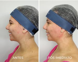 Royal Face Estética Montes Claros