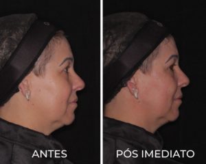 Royal Face Estética Montes Claros
