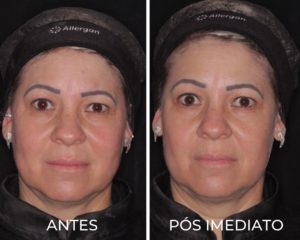Royal Face Estética Montes Claros
