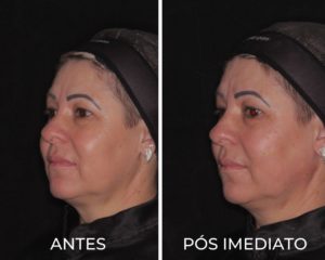 Royal Face Estética Montes Claros