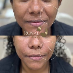 Royal Face Estética Montes Claros