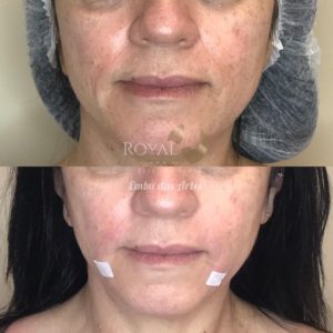 Royal Face Estética Montes Claros