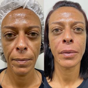 Royal Face Estética Montes Claros