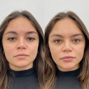 Royal Face Estética Montes Claros