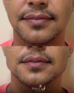 Royal Face Estética Montes Claros