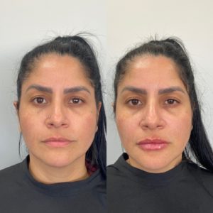 Royal Face Estética Montes Claros