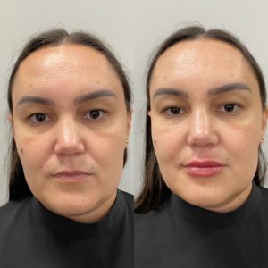 Royal Face Estética Montes Claros