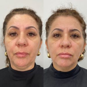 Royal Face Estética Montes Claros