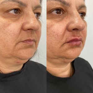 Royal Face Estética Montes Claros