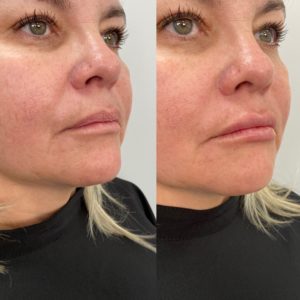 Royal Face Estética Montes Claros