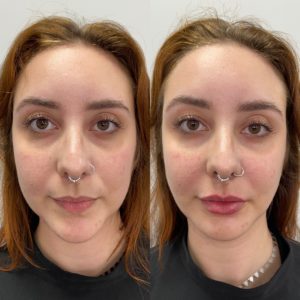 Royal Face Estética Montes Claros
