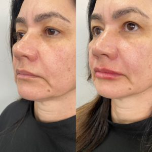Royal Face Estética Montes Claros