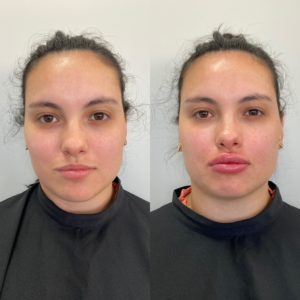 Royal Face Estética Montes Claros