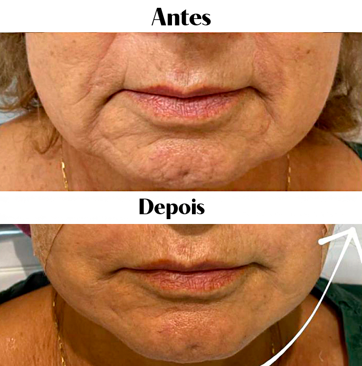 Royal Face Estética Montes Claros
