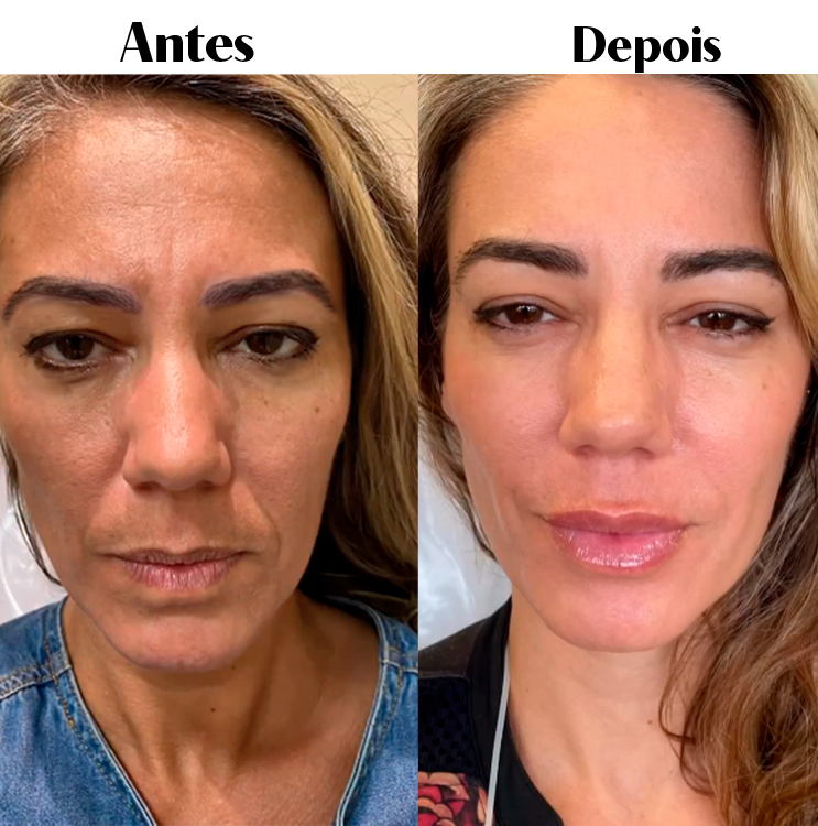 Royal Face Estética Montes Claros