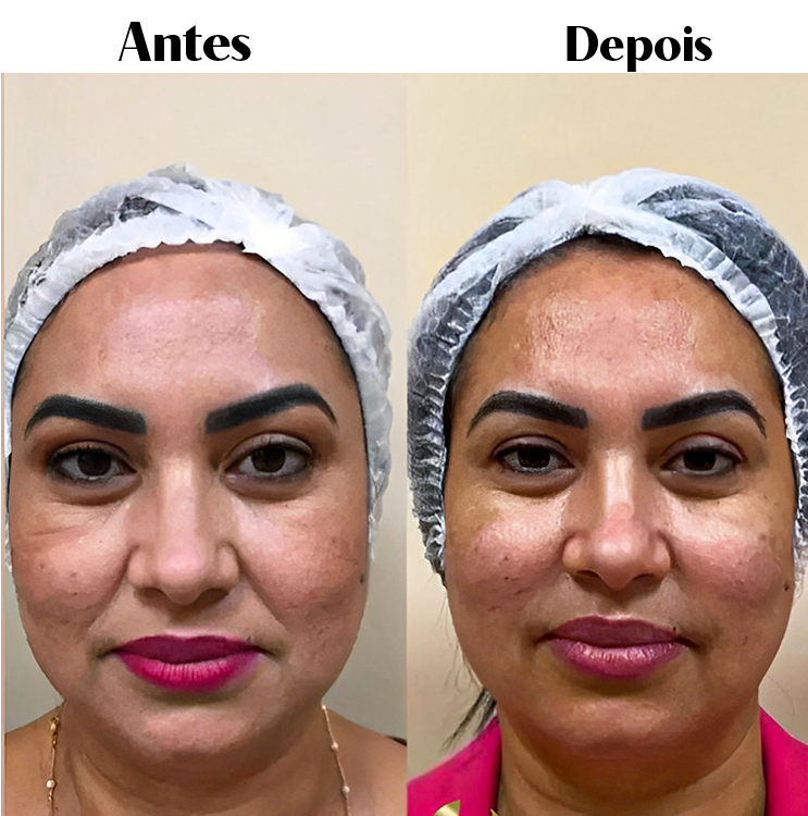 Royal Face Estética Montes Claros