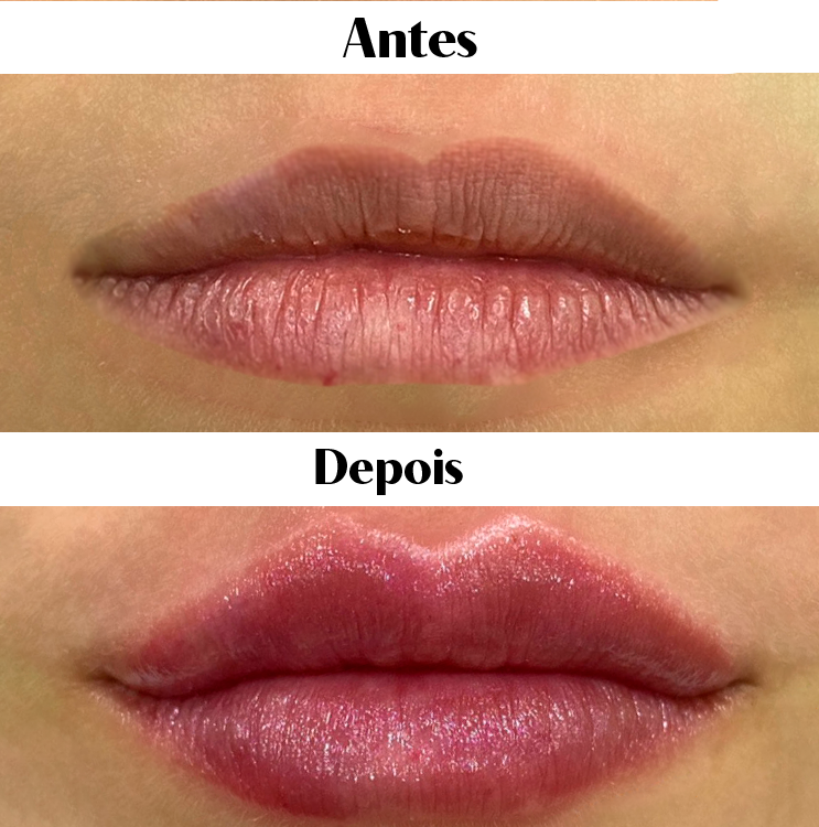 Royal Face Estética Montes Claros