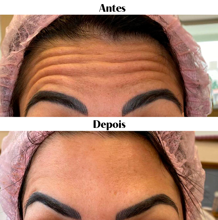 Royal Face Estética Montes Claros