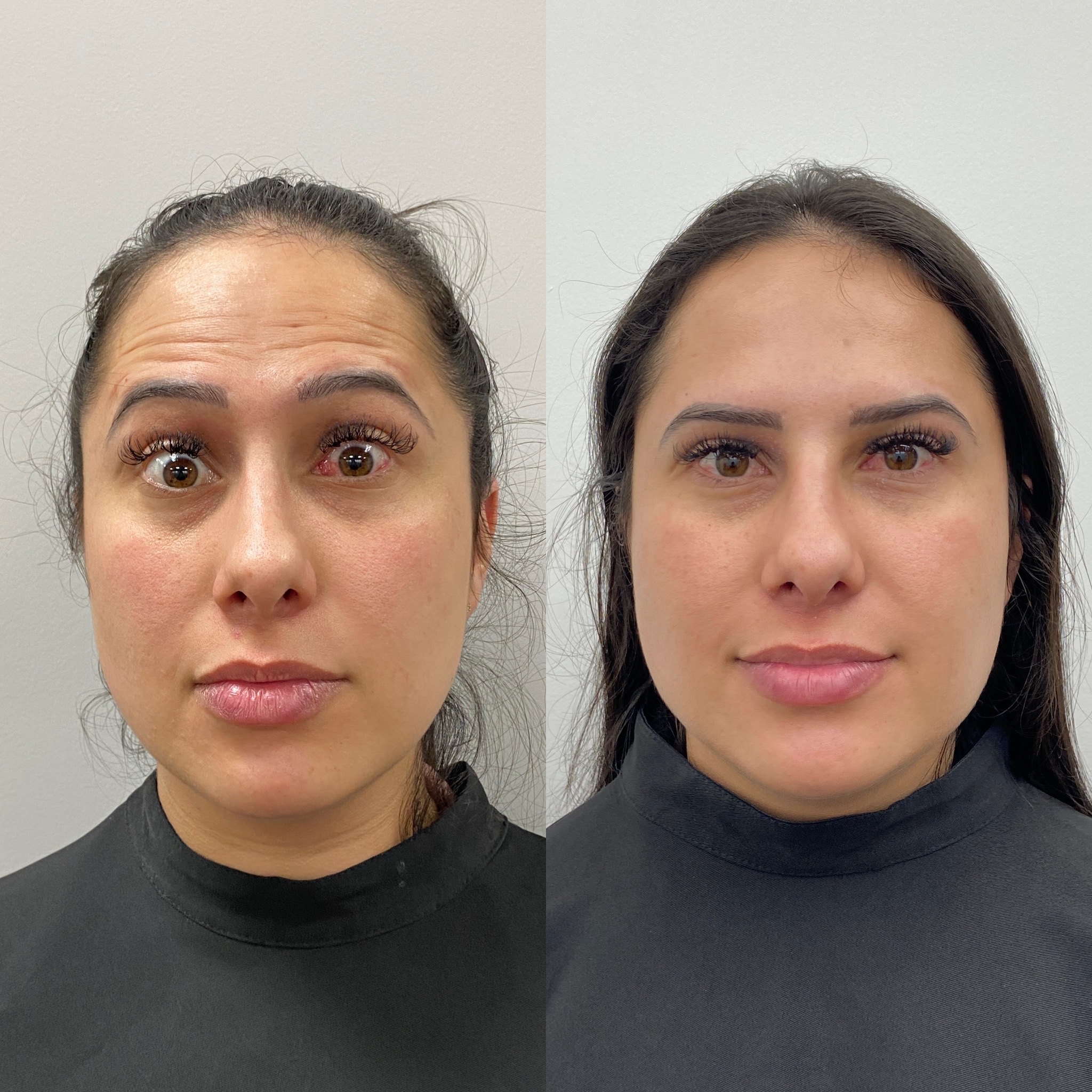 Royal Face Estética Montes Claros