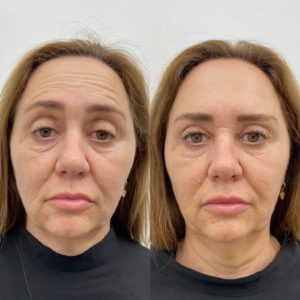 Royal Face Estética Montes Claros