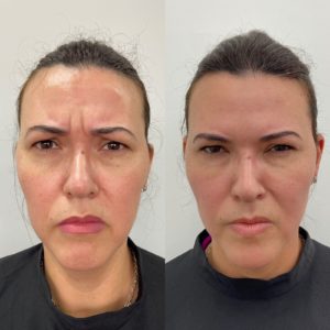 Royal Face Estética Montes Claros