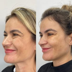 Royal Face Estética Montes Claros