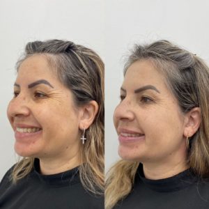 Royal Face Estética Montes Claros