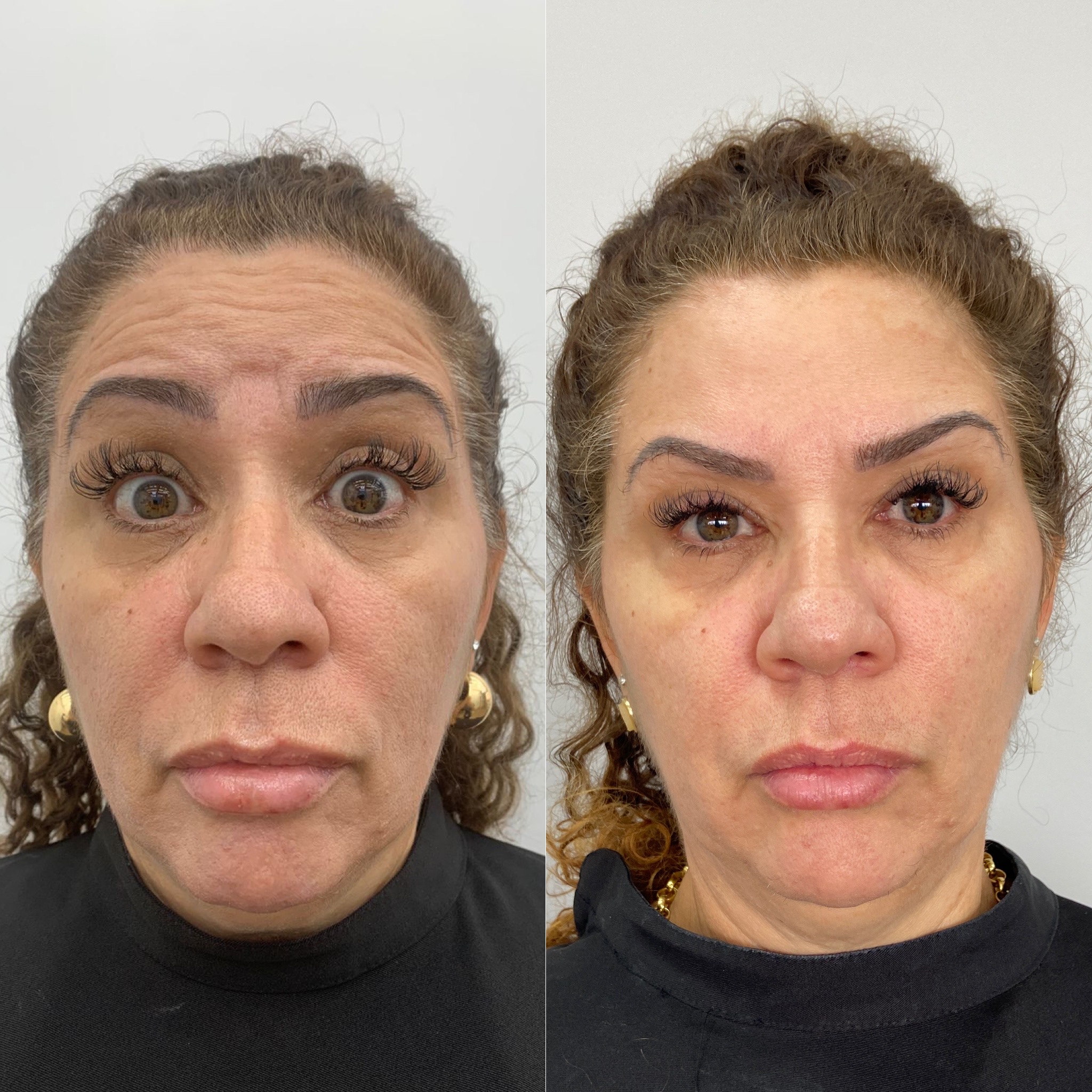 Royal Face Estética Montes Claros