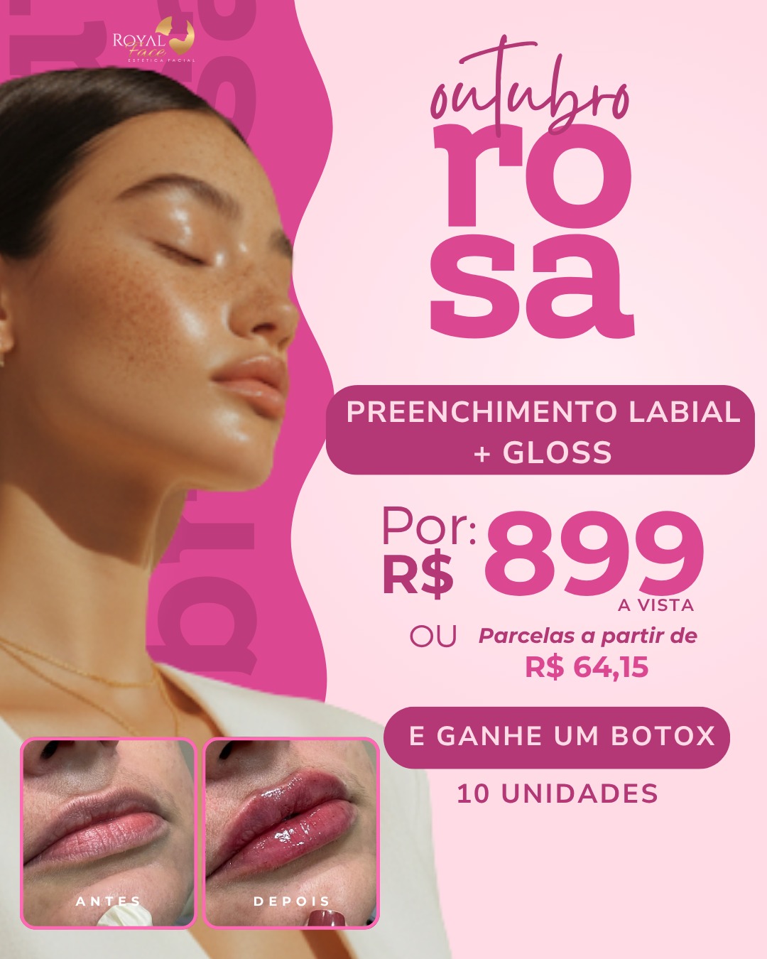 Outubro Rosa Royal Face Montes Claros clínica de Estética